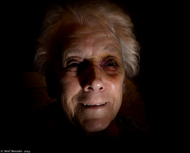 A woman, victim of domestic abuse, with a black eye