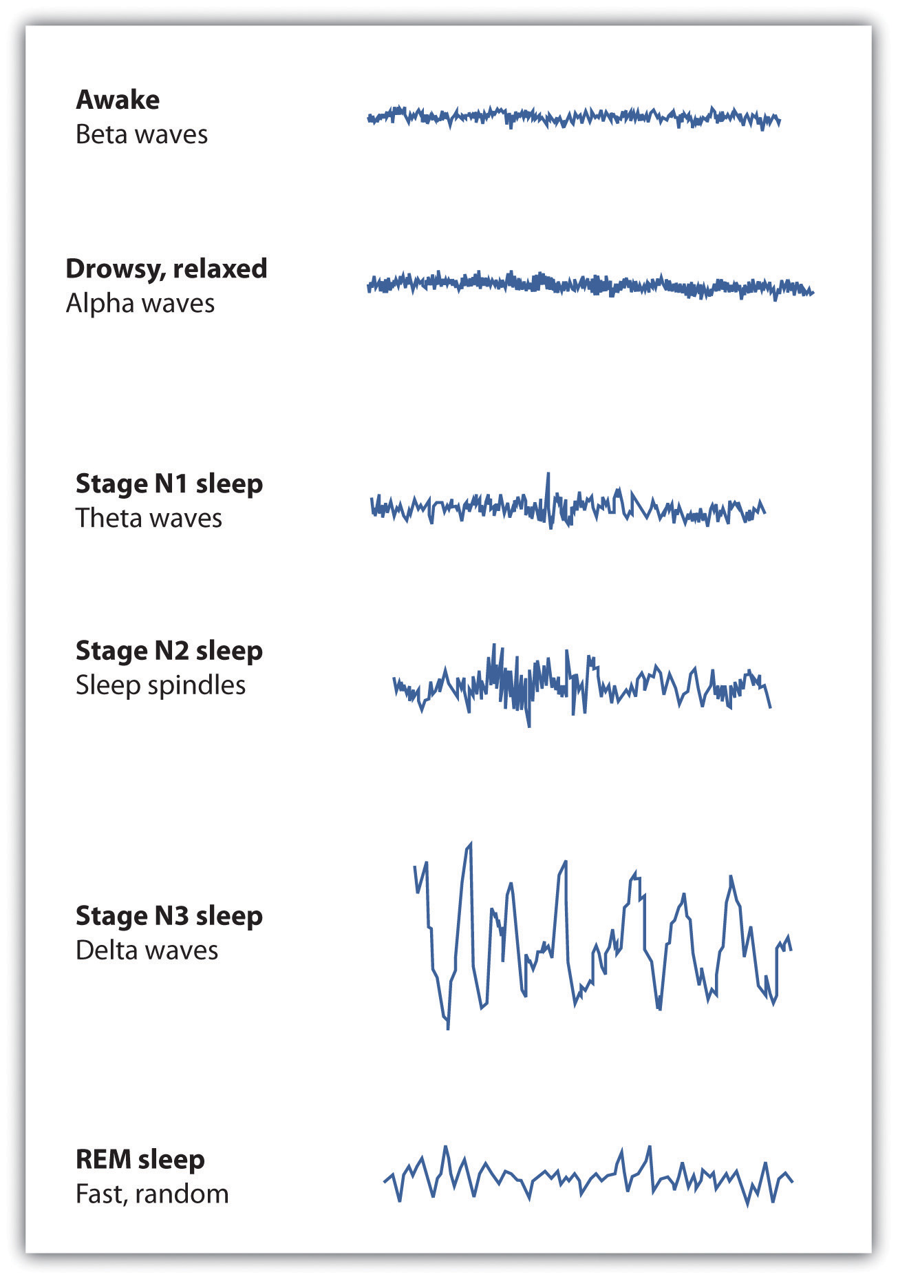 Each stage of sleep has its own distinct pattern of brain activity.
