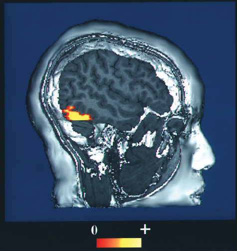 fMRI image