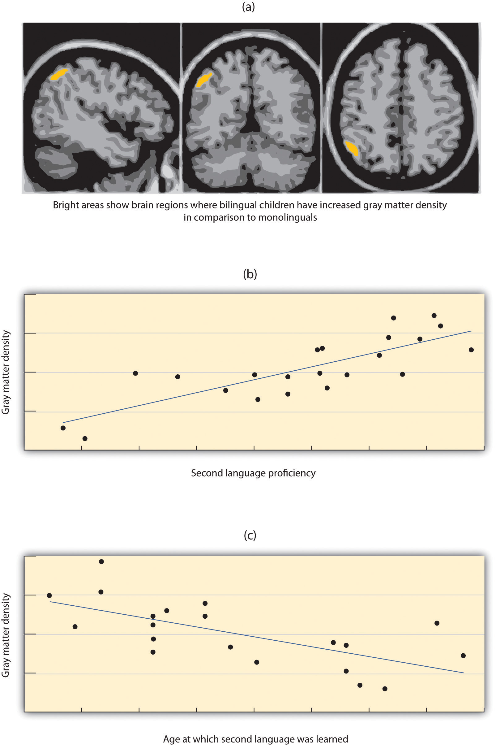 Andrea Mechelli and her colleagues (2004) found that children who were bilingual had increased gray matter density (i.e., more neurons) in cortical areas related to language in comparison to monolinguals (panel a), that gray matter density correlated positively with second language proficiency (panel b) and that gray matter density correlated negatively with the age at which the second language was learned (panel c).