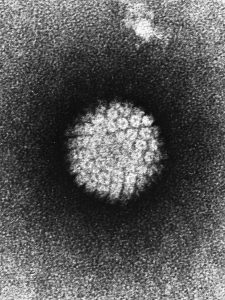 Electron micrograph of HPV.