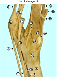 dissected hock specimen showing medial aspect of limb