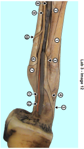 dissection image of lower limb showing medial view