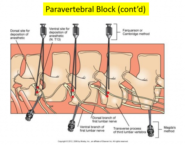 Local anesthesia Large Animal Surgery Supplemental Notes