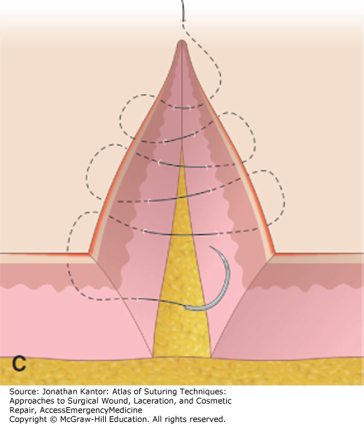 Suturing intradermal/subcuticular pattern Large Animal Surgery