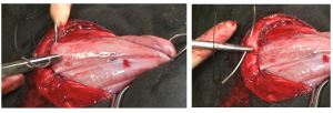 two images showing one suture bite in the muscle and one in the rumen, cushing pattern