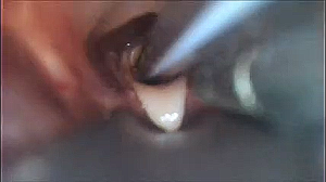 Proper placement of endotracheal tube in a cat.