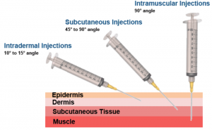 Varying angle of injection ID, SQ, IM