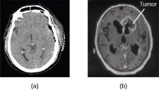 1.9 The Brain and Spinal Cord – Human Biology