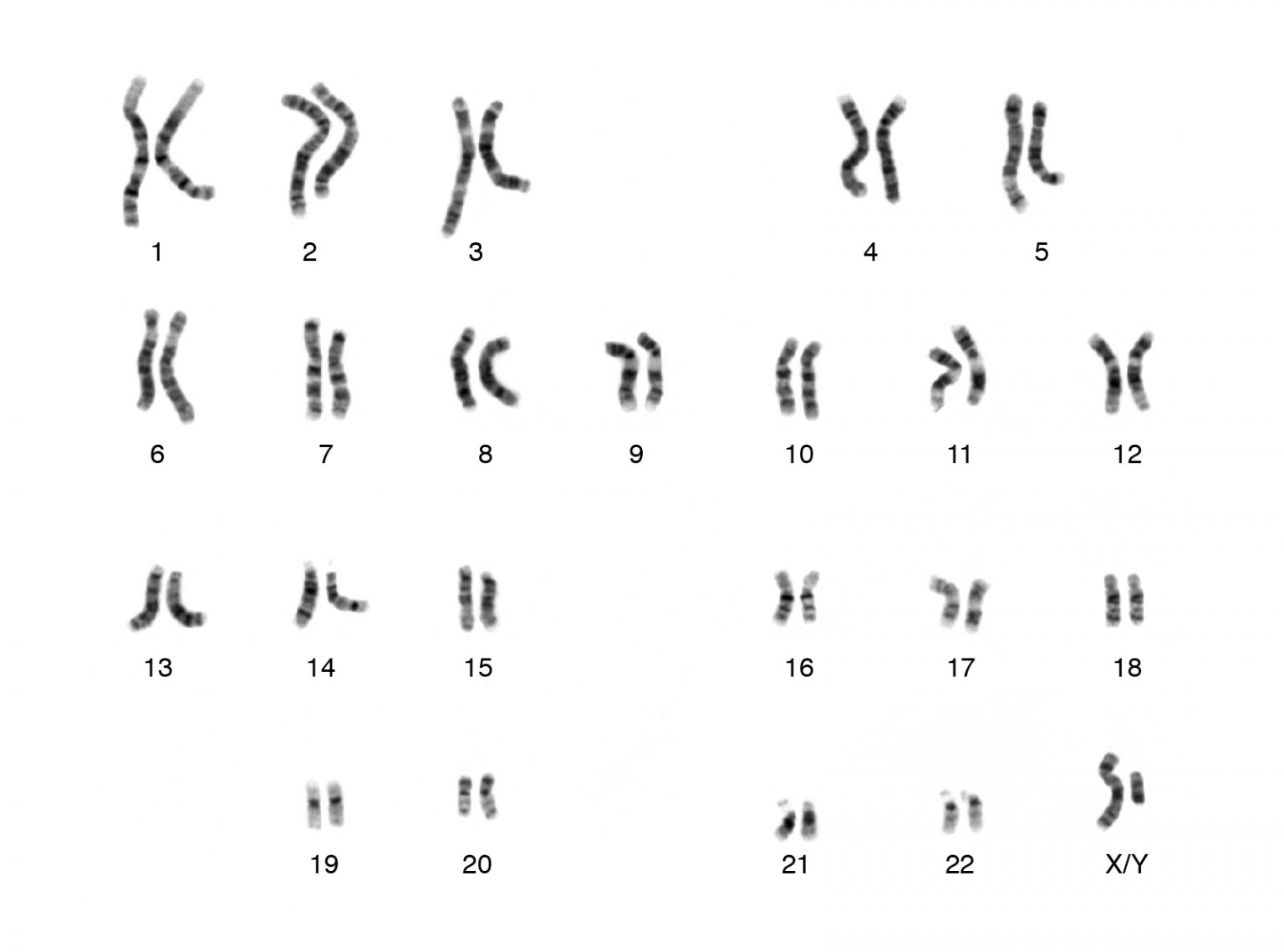 4.2 Meiosis and Gametogenesis – Human Biology 2nd edition