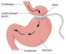 3.11 Hunger, Eating, and Weight – Human Biology 2nd edition