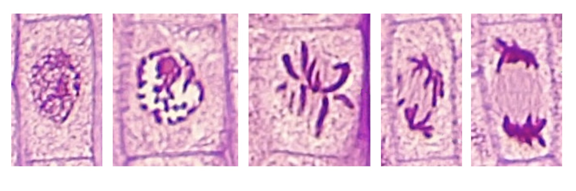 Onion Root Tip Mitosis Stages Labeled