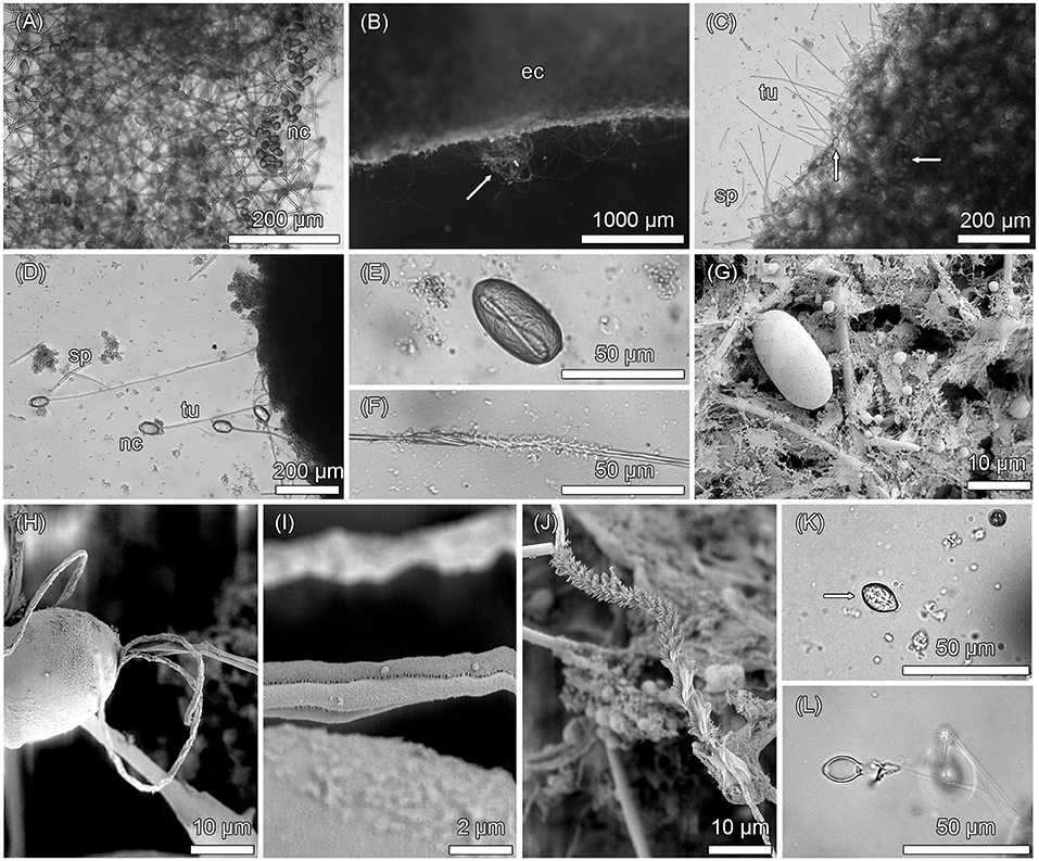 Multiple magnifications of Haliclona cnidata