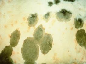 Papule
