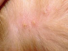 Pustule