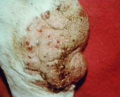 Hemorrhagic bullae