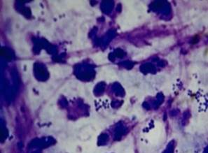 Cocci bacteria, neutrophils and nuclear streaming