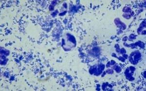 Rods, cocci and degenerate neutrophils.
