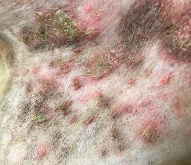 Multiple papules, a few pustules and crusts on the axilla and chest of a dog with superficial pyoderma secondary to atopic dermatitis