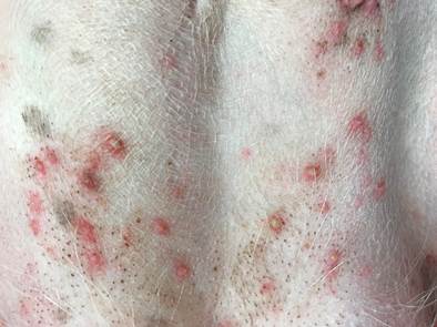 Multiple pustules on the abdomen ofa dog with superficial pyoderma secondary to atopic dermatitis