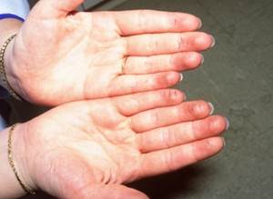 hands, palms up, fingertips slightly dirty