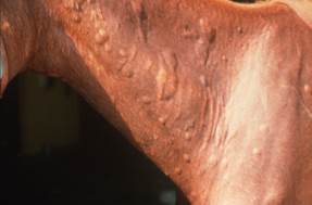 Urticarial lesions on side of horses neck