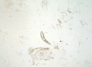Microscopic image of translucent adult D. canis mite