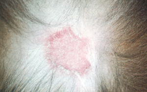 sign of Demodicosis with red patch on white hair