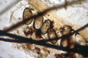 microscopic image of group of small brown eggs in a row under pieces of hair
