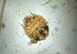 microscopic image of gold-colored round mite
