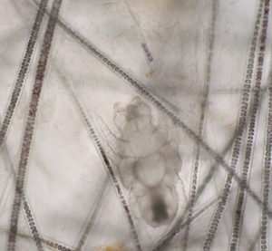 microscopic image of mite with hook-like mouth parts underneath strands of hair