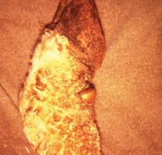 golden-colored excess sack of tissue near rear legs of brown cattle