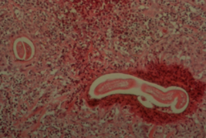 microscopic image of red tissue larva