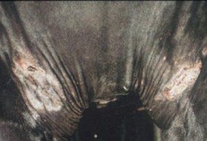crusting and scabs on black horse's forelegs