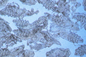 Microscopic image of brown, translucent mites