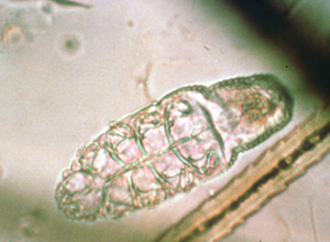 microscopic image of surface mite, translucent with green outline