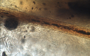 Ectothrix spores