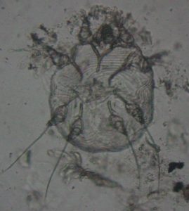 black-and-white microscopic image of round, translucent mite