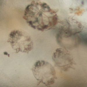 microscopic image of five round translucent mites
