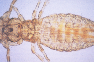 Damalinia ovis (body louse): biting lice, wide head and brown stripes on abdomen