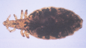 Linognathus ovillus (face louse); Linognathus pedalis (foot louse), black spotted body and narrow pointed head