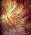 white scales distributed throughout swirl of brown horse hair