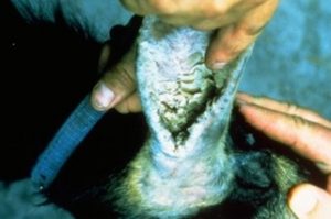 excessive cerumen and scales accumulation in the ear canal