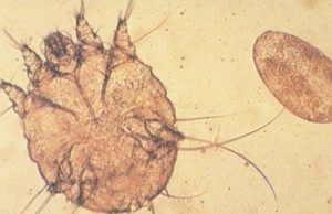 microscopic image of brown round parasite and oval-shaped cell with beige background
