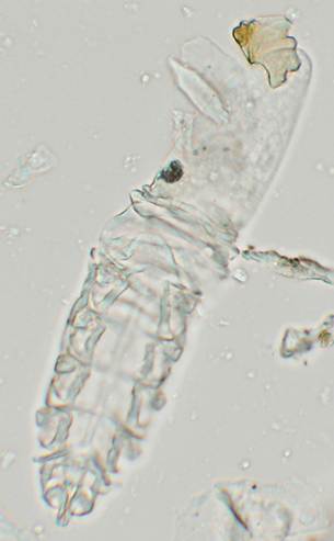 Demodex equi mite.