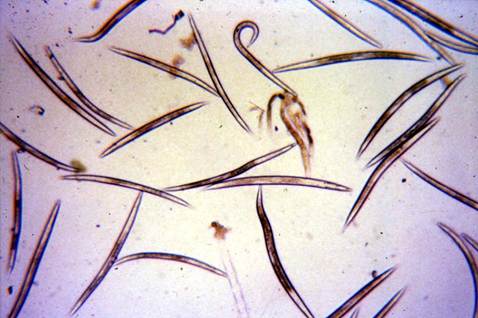 Third stage larvae of Pelodera strongyloides.