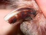 close up of black discoloration of toenail