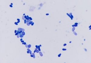 microscopic image of squamous cells shown as blue, thin flat cells