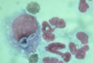histopathology of Sporothrix schenckii; purple, cigar-shaped against a blue-green background