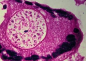 purple dimorphic soil fungus in spherule form with endospores